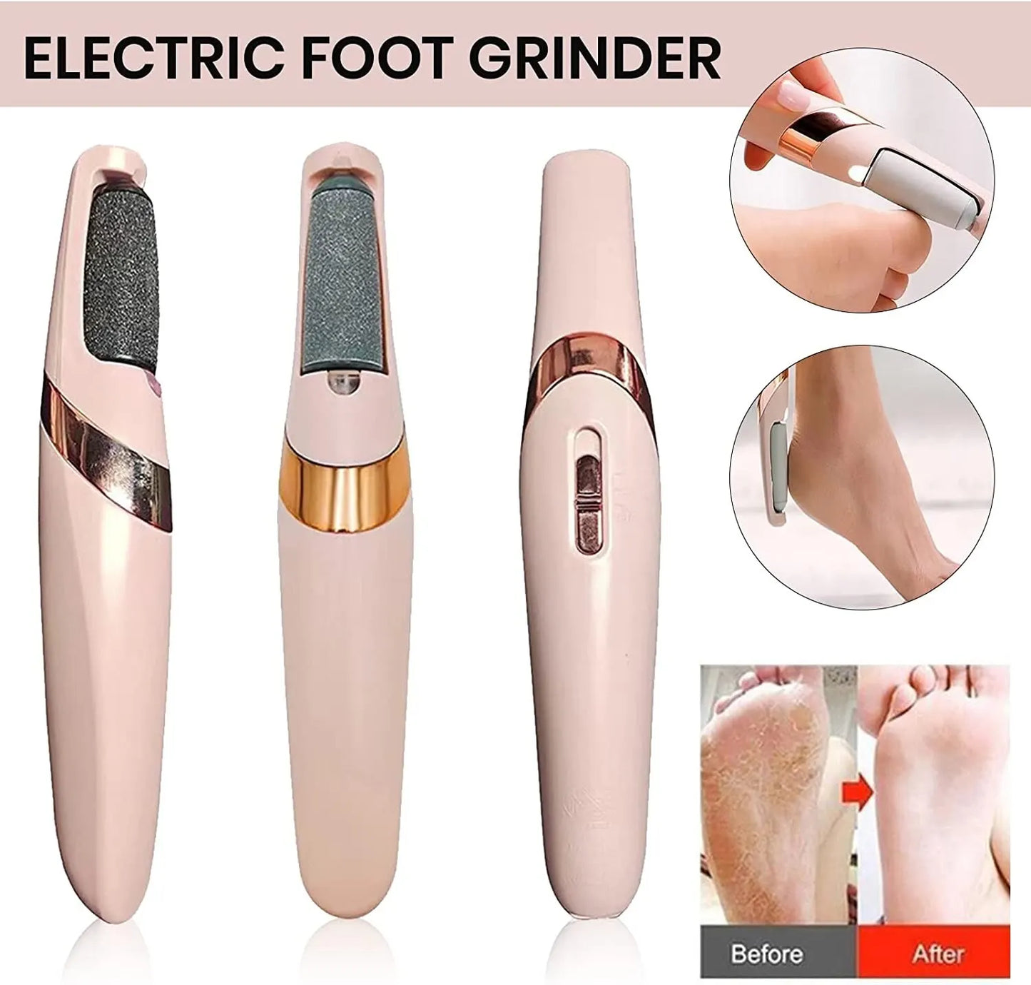 Pink Electric Foot File Callus Remover Pedicure Care Tool